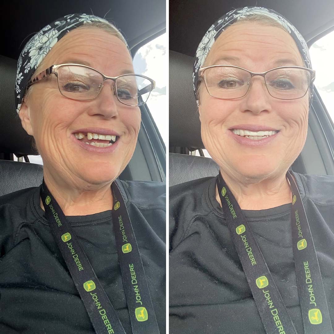 ¡Echa un vistazo a mi nueva sonrisa increíble!