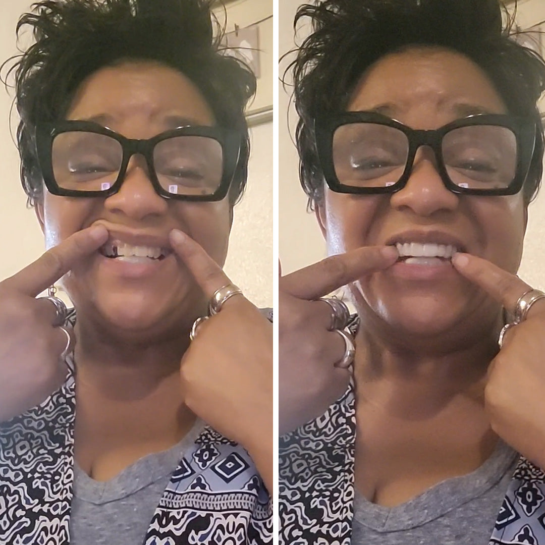 Sigo amando mi sonrisa 4 años después