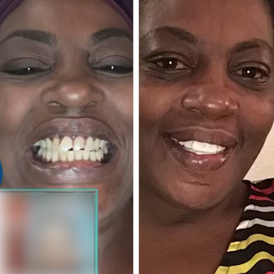 Ya no tengo que ocultar mi sonrisa.