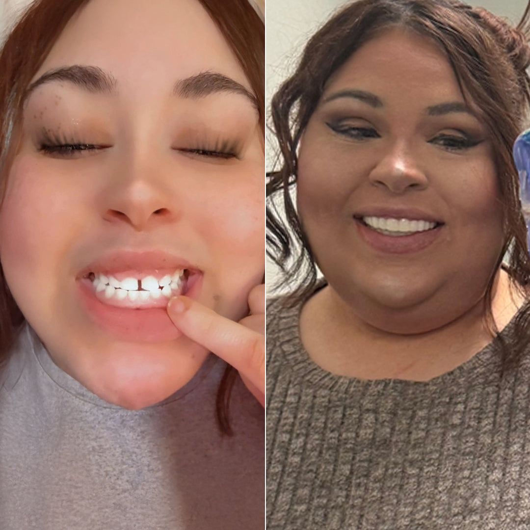 Pop On brought back my confidence!