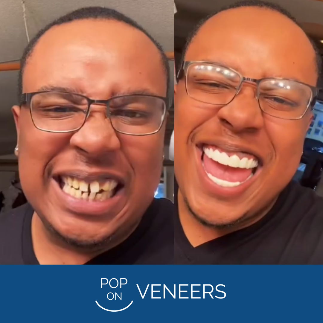 ¡Pop On Veneers me salvó la vida!
