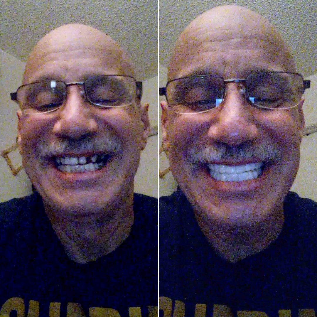 I couldn’t believe how good my smile looked!