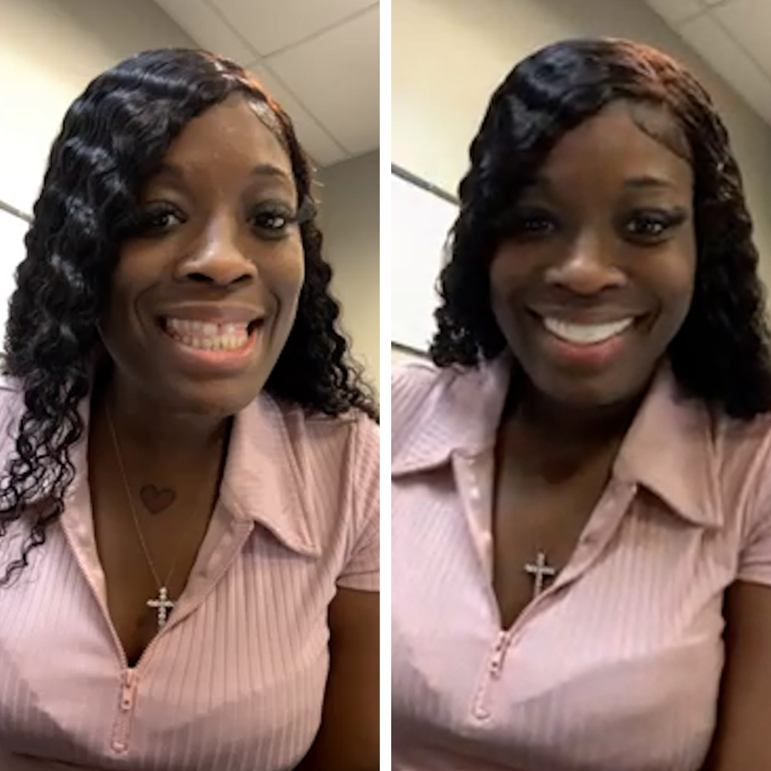 ¡ME ENCANTA mi nueva sonrisa!