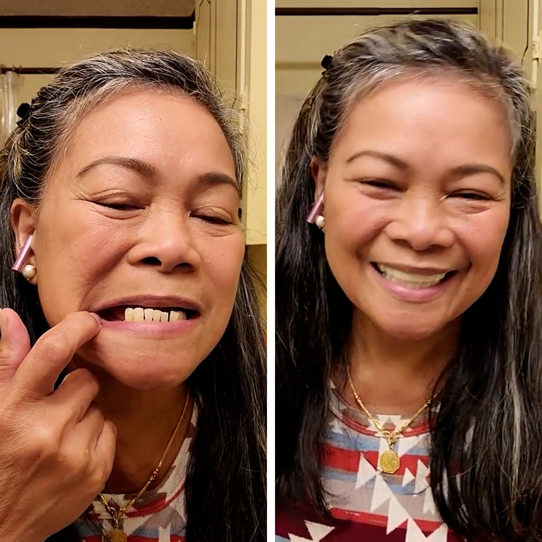 Me encanta mi nueva sonrisa.