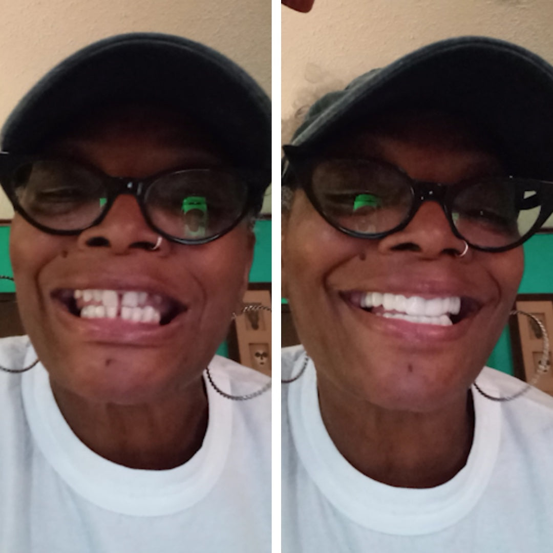 ¡Será mejor que vayas a por unos Pop On's!