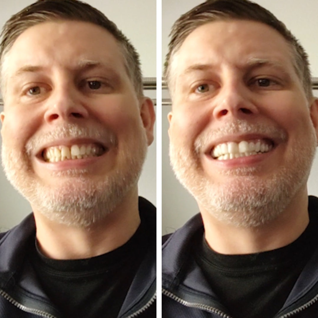 ¡Qué diferencia hace Pop On!