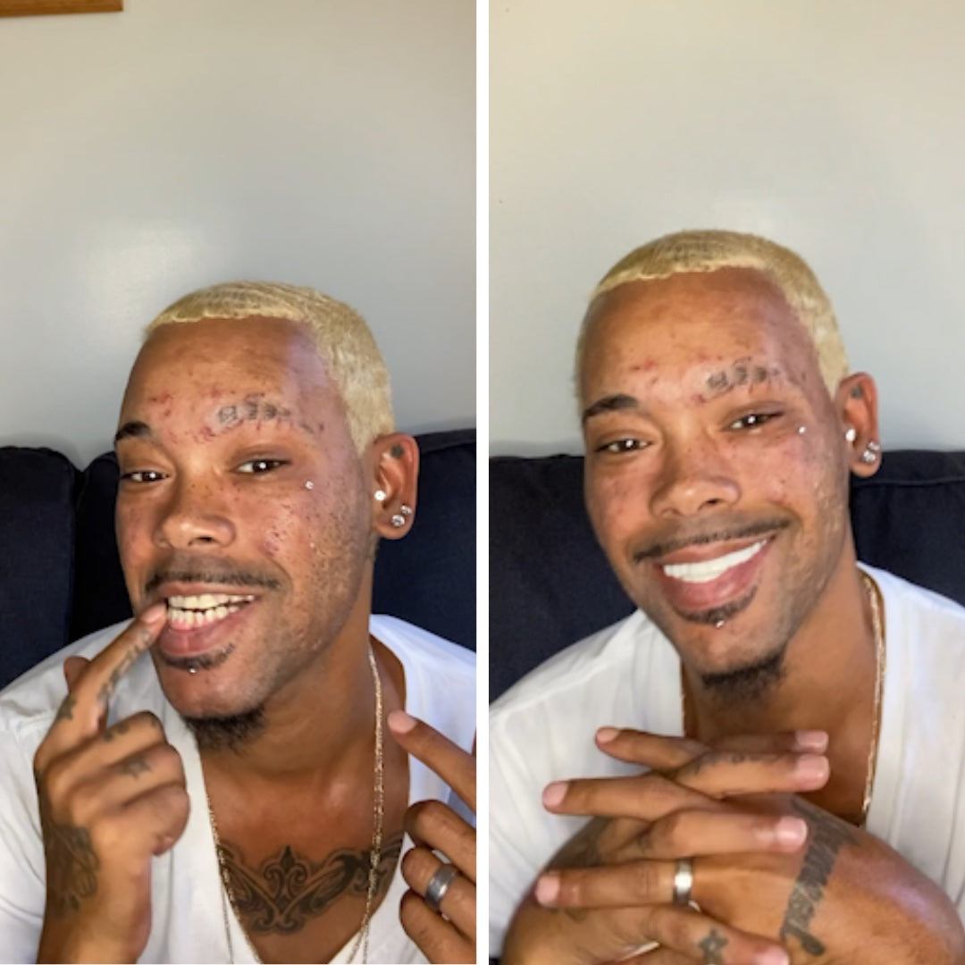 Sonrisa de estrella de cine