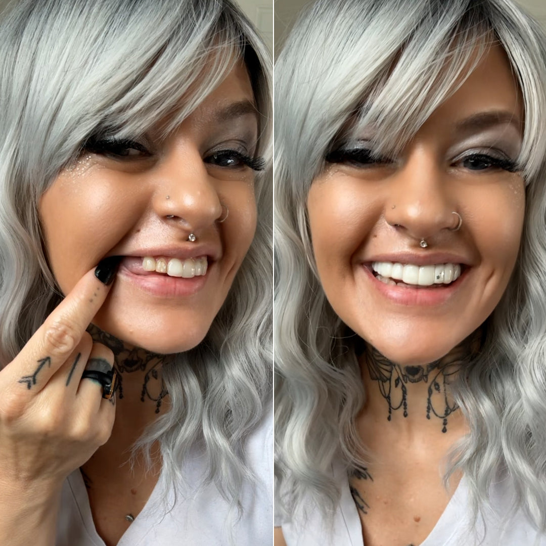 Tenemos que hablar de las sonrisas