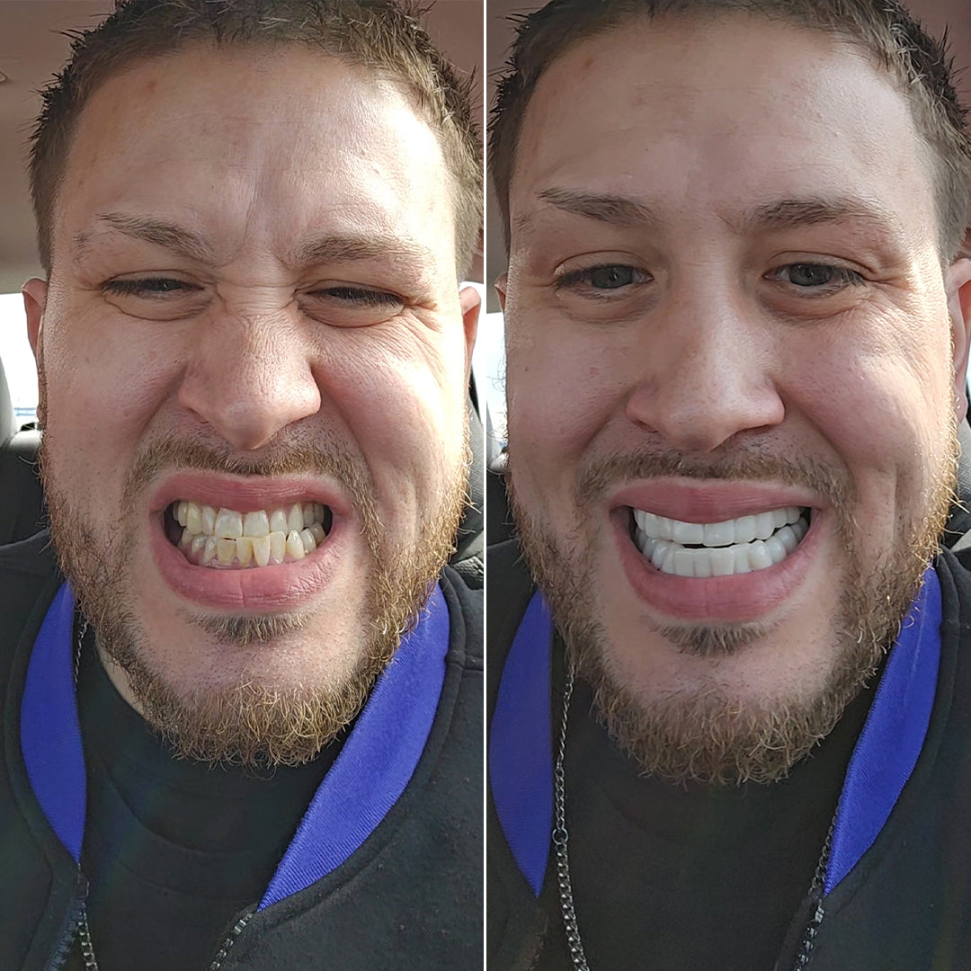 ¡Mira la diferencia!
