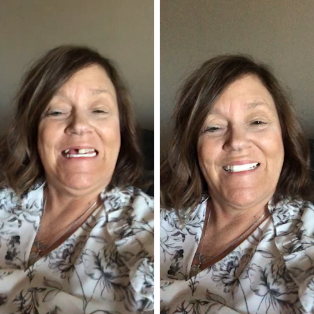 Increíblemente feliz con mis Pop Ons