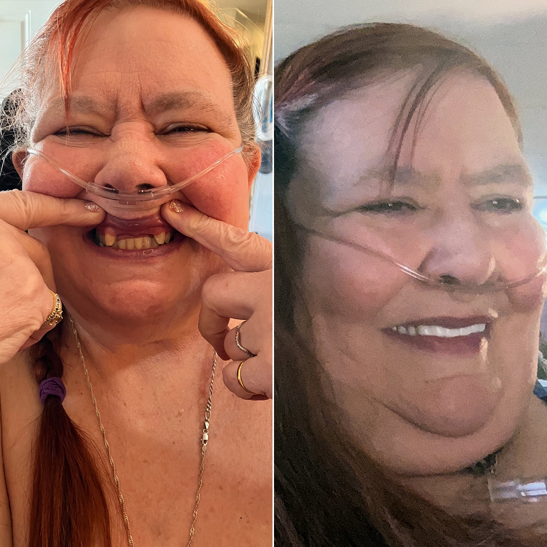 ¡Ahora puedo sonreír al mundo!