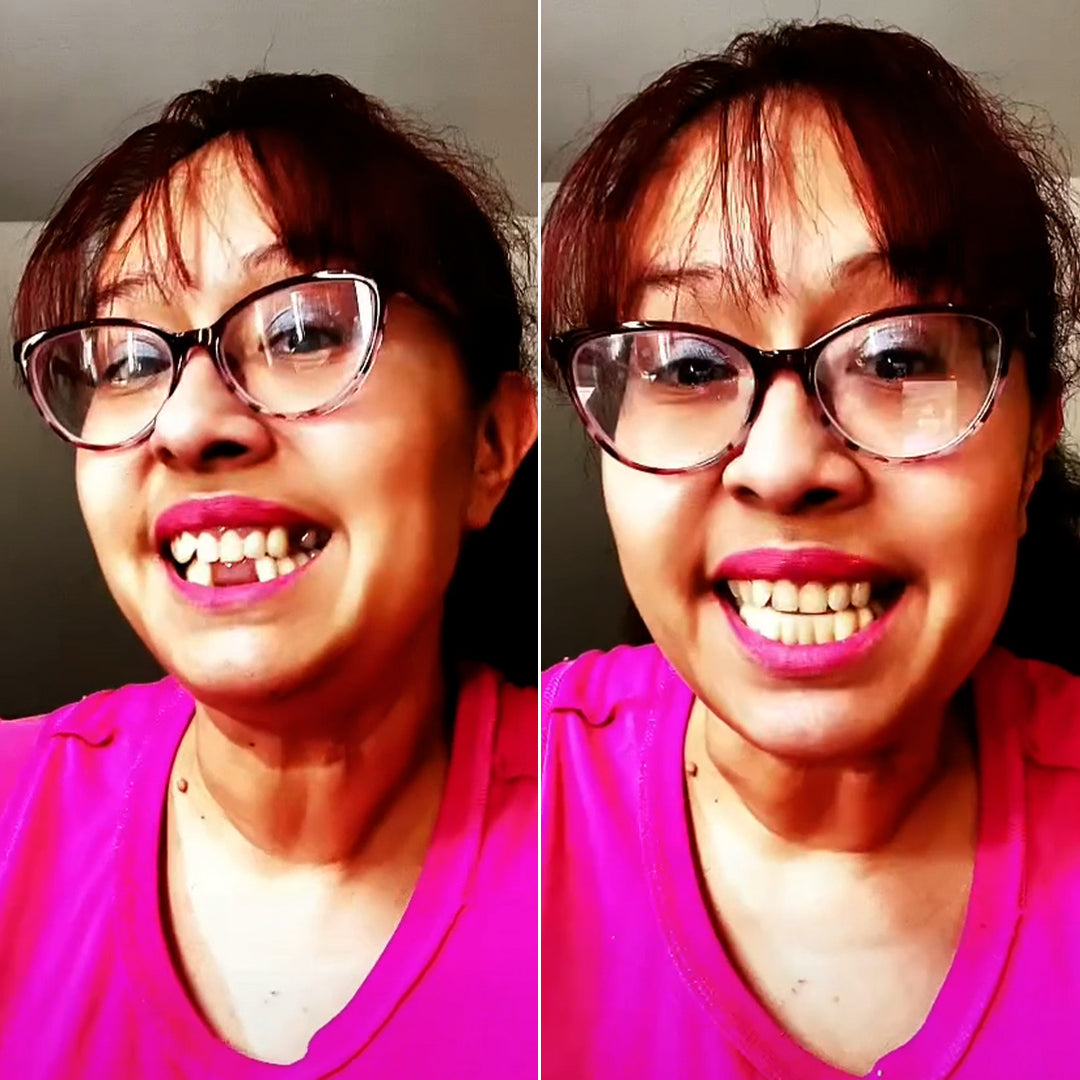 Perfect smile with Pop On!