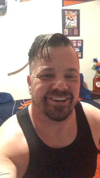 Una gran diferencia en mi sonrisa.