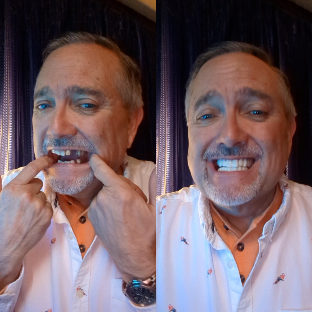 ¡Escucha cómo entran!