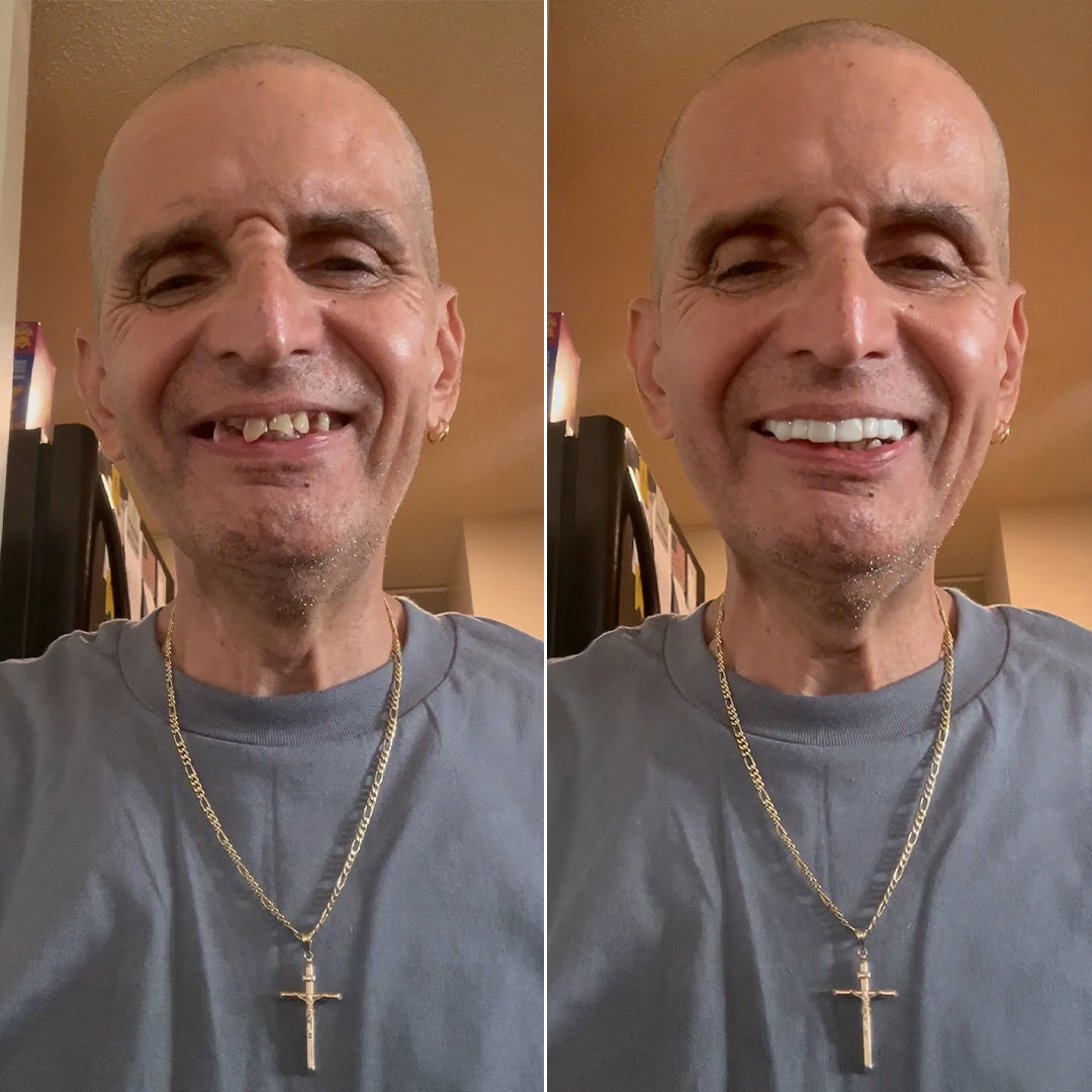 ¡Mira la diferencia en mi sonrisa!