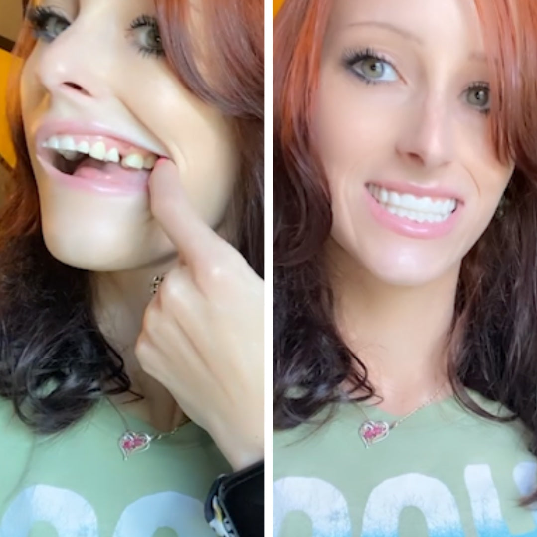 Tengo mucha más confianza en mi sonrisa.