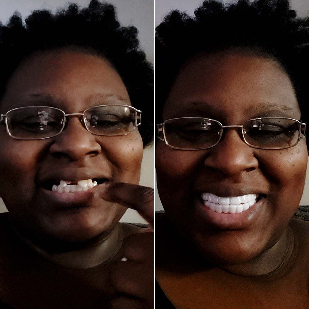 ¡Estoy encantada con mis nuevas carillas Pop On!