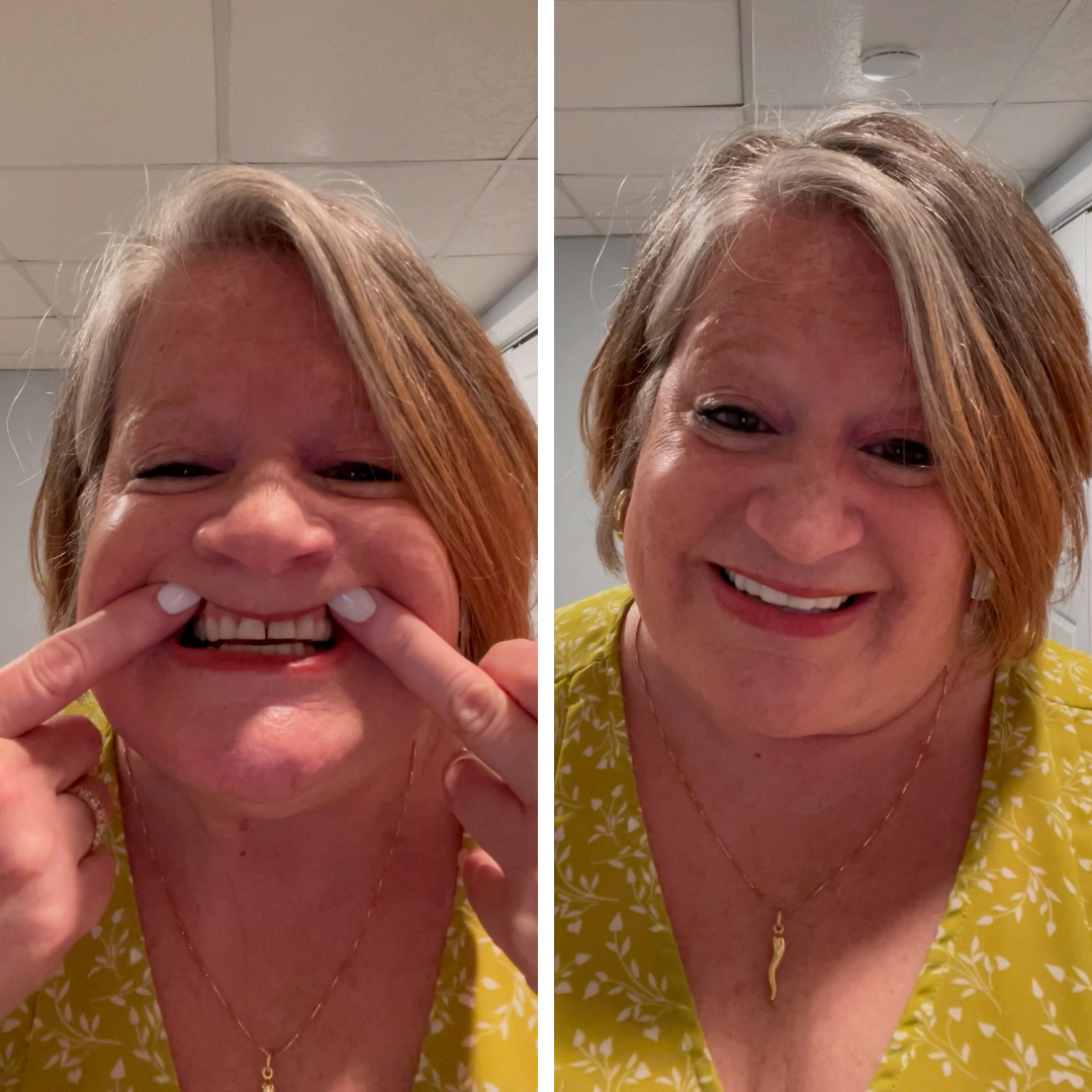 Estoy encantado con mis Pop Ons.