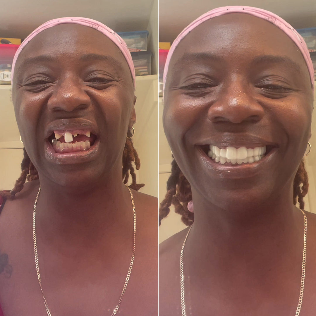 Best decision for my smile