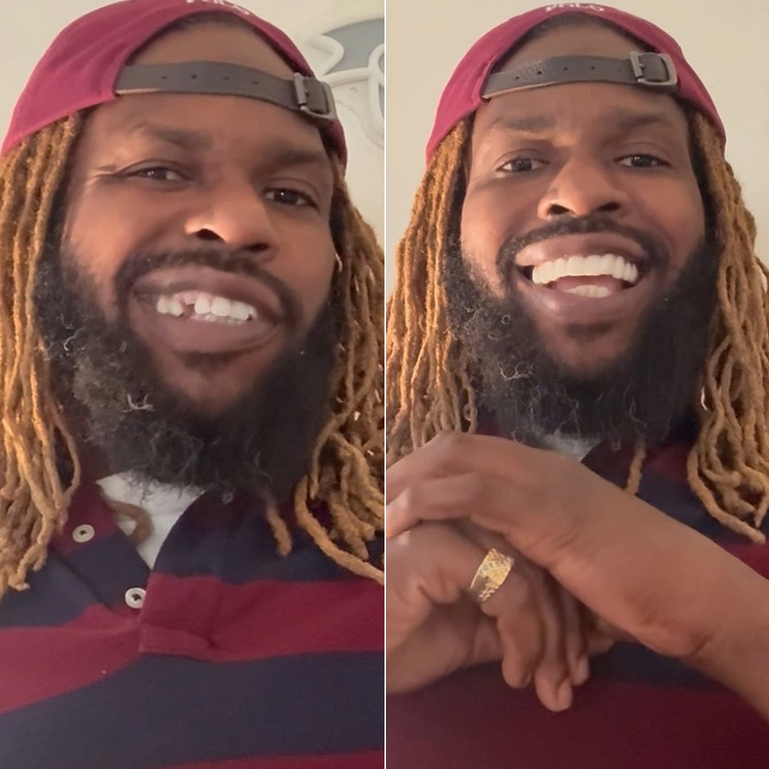 Una sonrisa que lo tiene todo