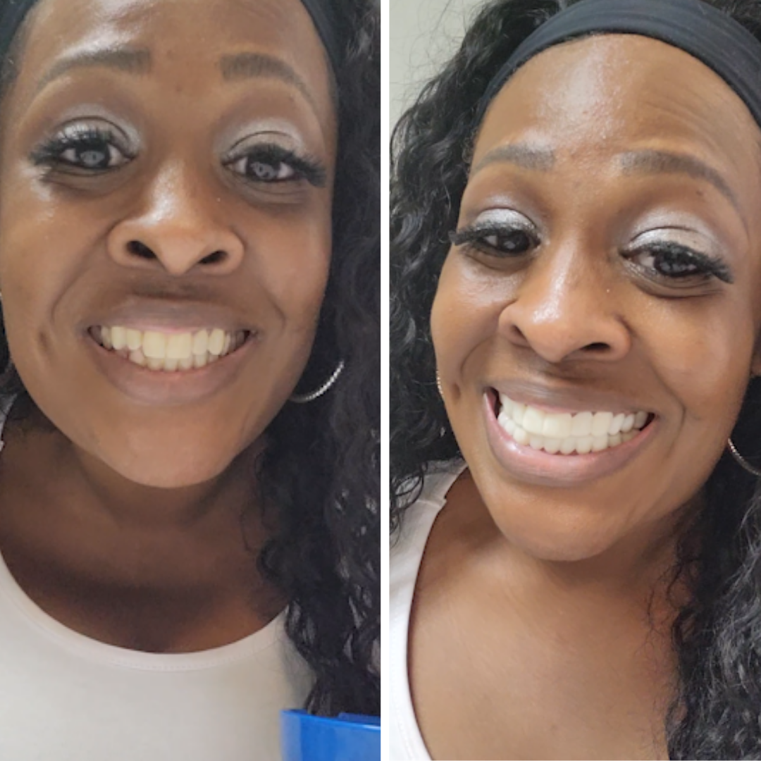 Un cambio total en el juego.