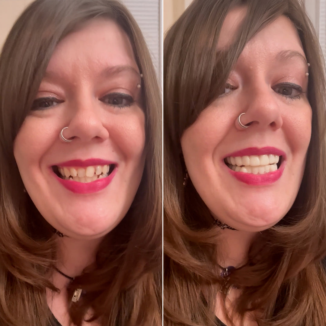 Check out how easy it is to upgrade your smile!