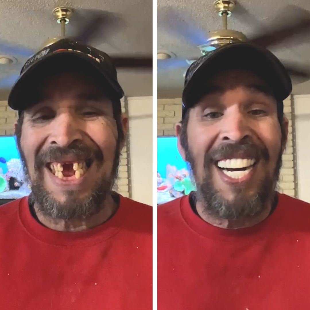 ¡100% satisfecho y amando mi sonrisa!