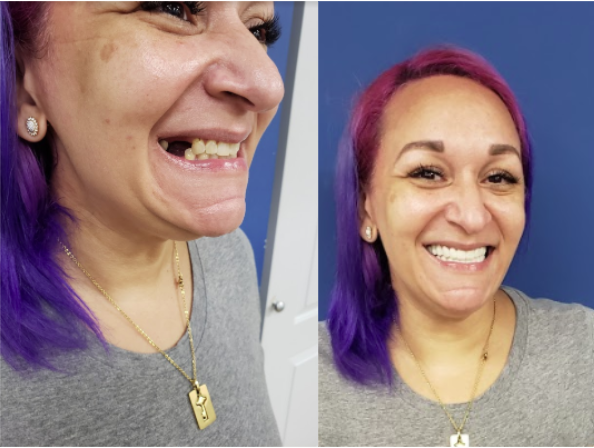 ¡Pop On me tiene cubierto!