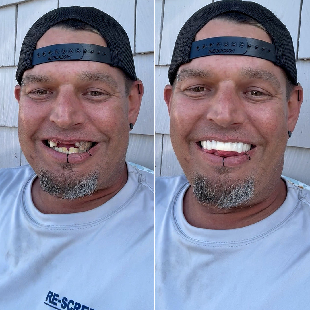Pop On can change your life!