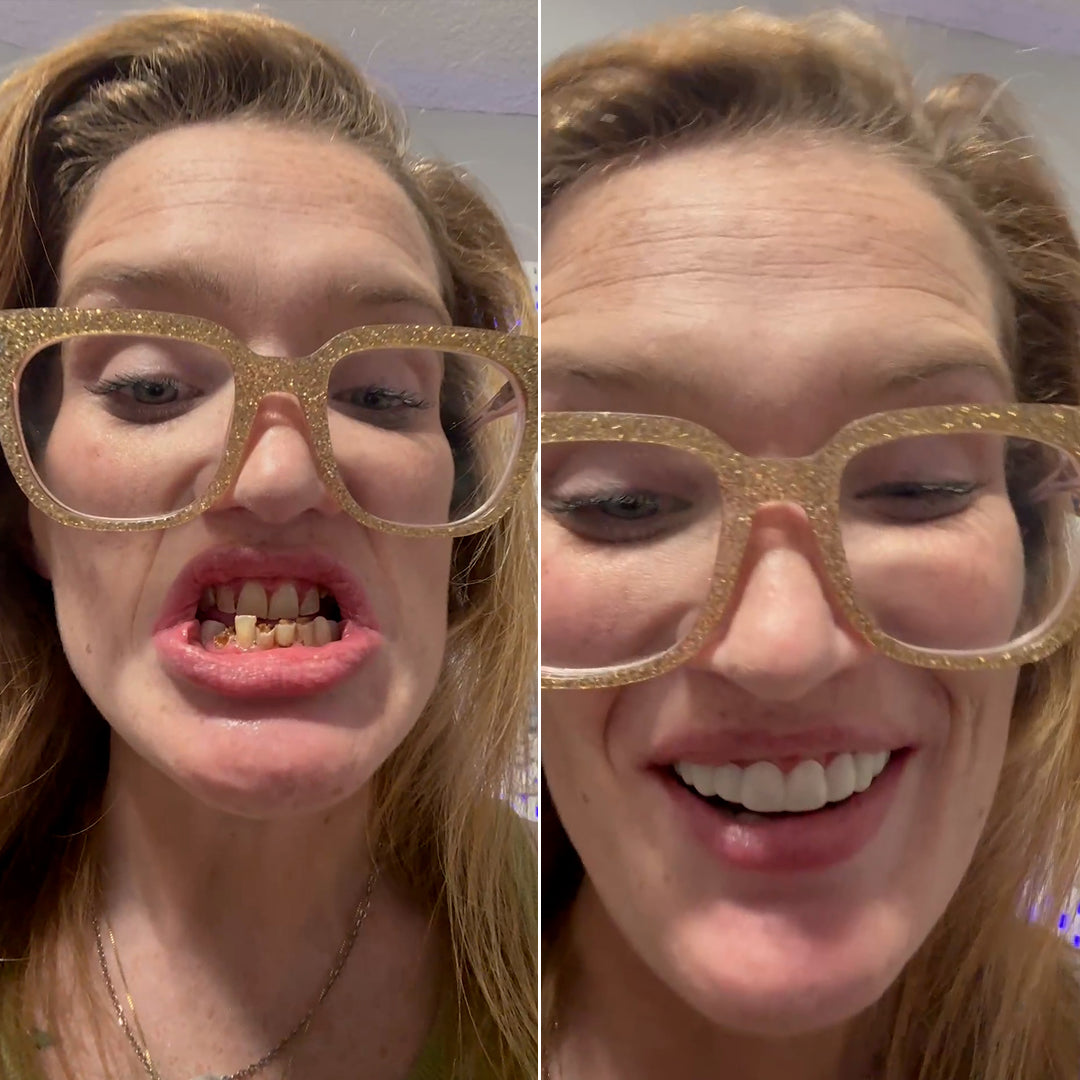 A beautiful new smile is within reach