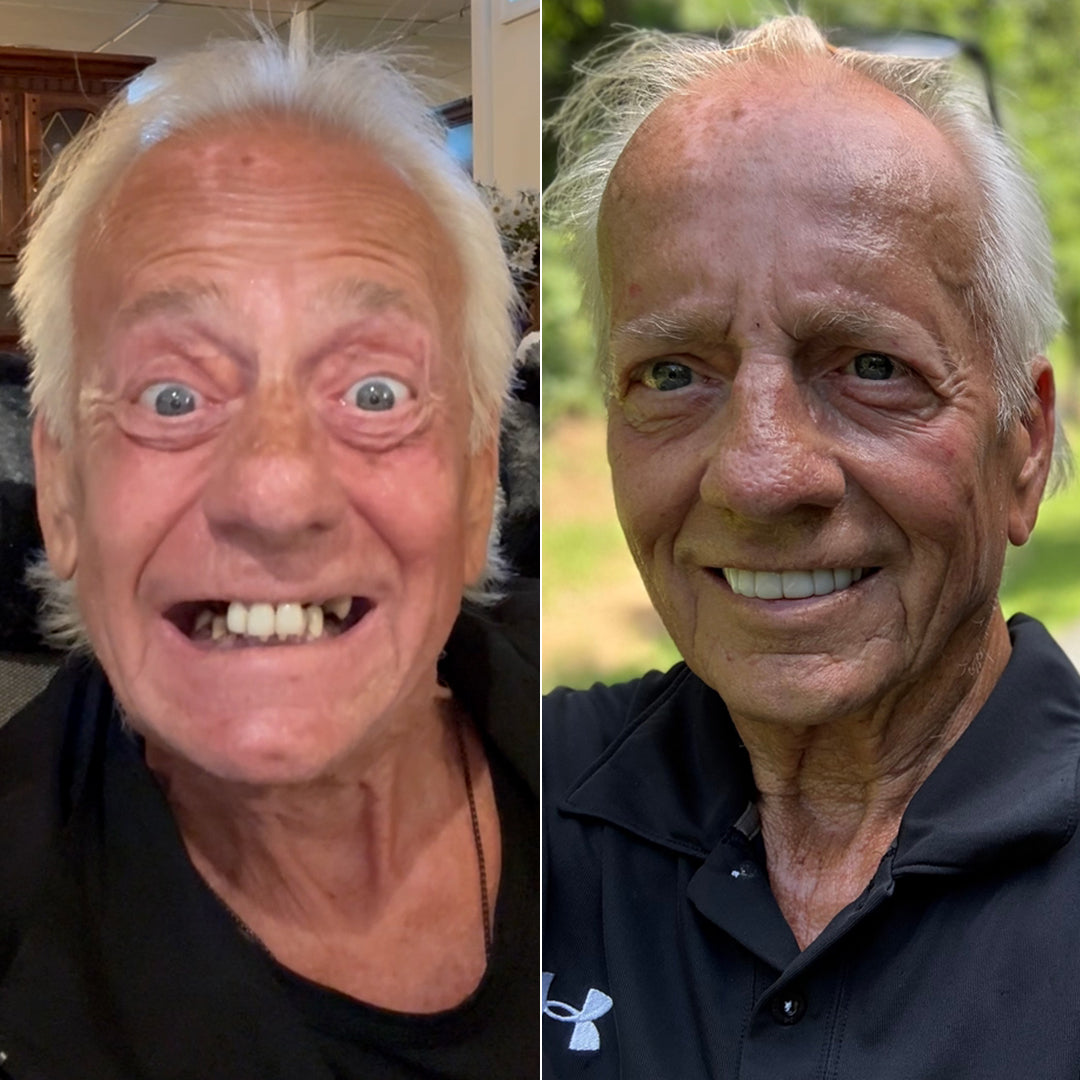 ¡Esta transformación de la sonrisa es increíble!