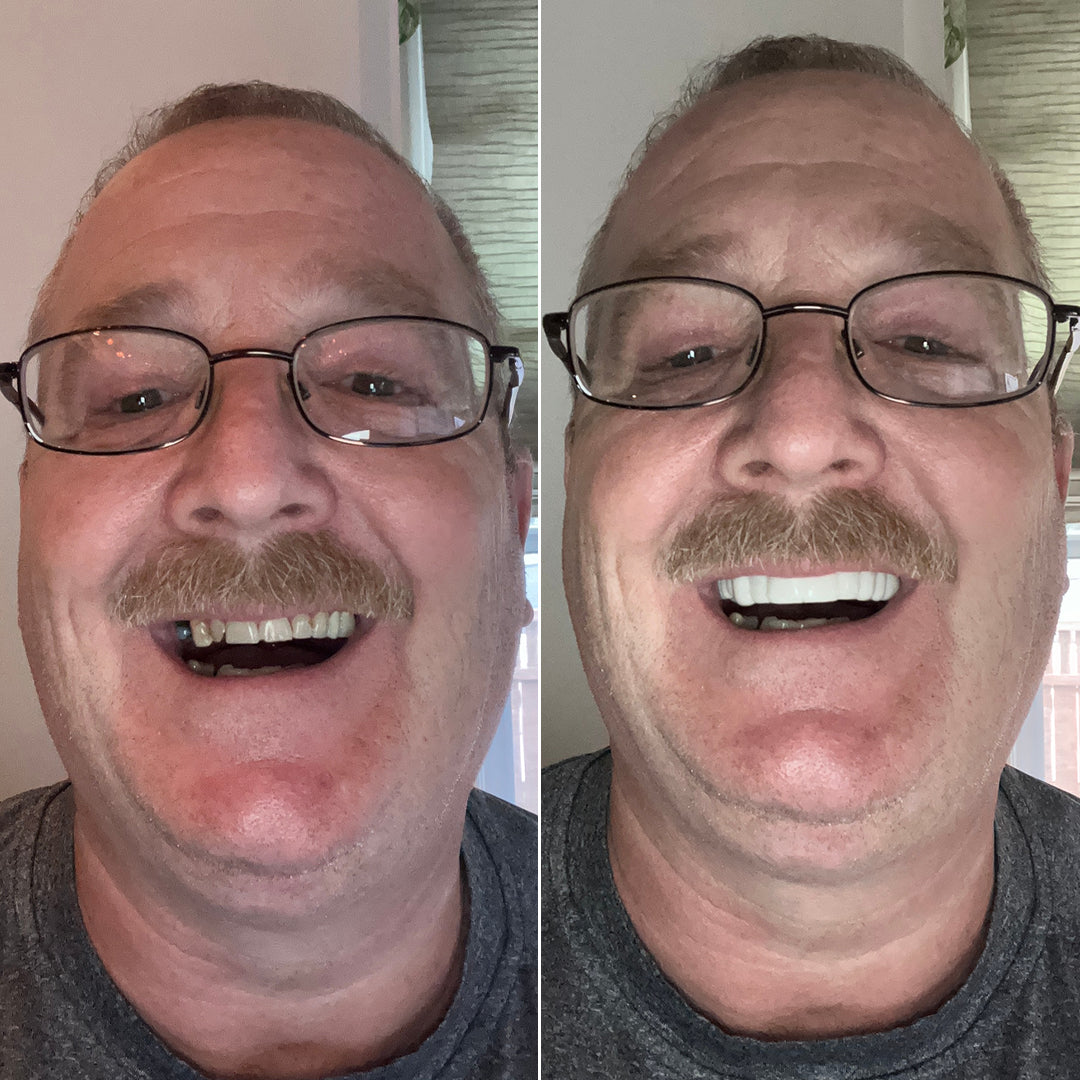 A smile you’ll want in every photo