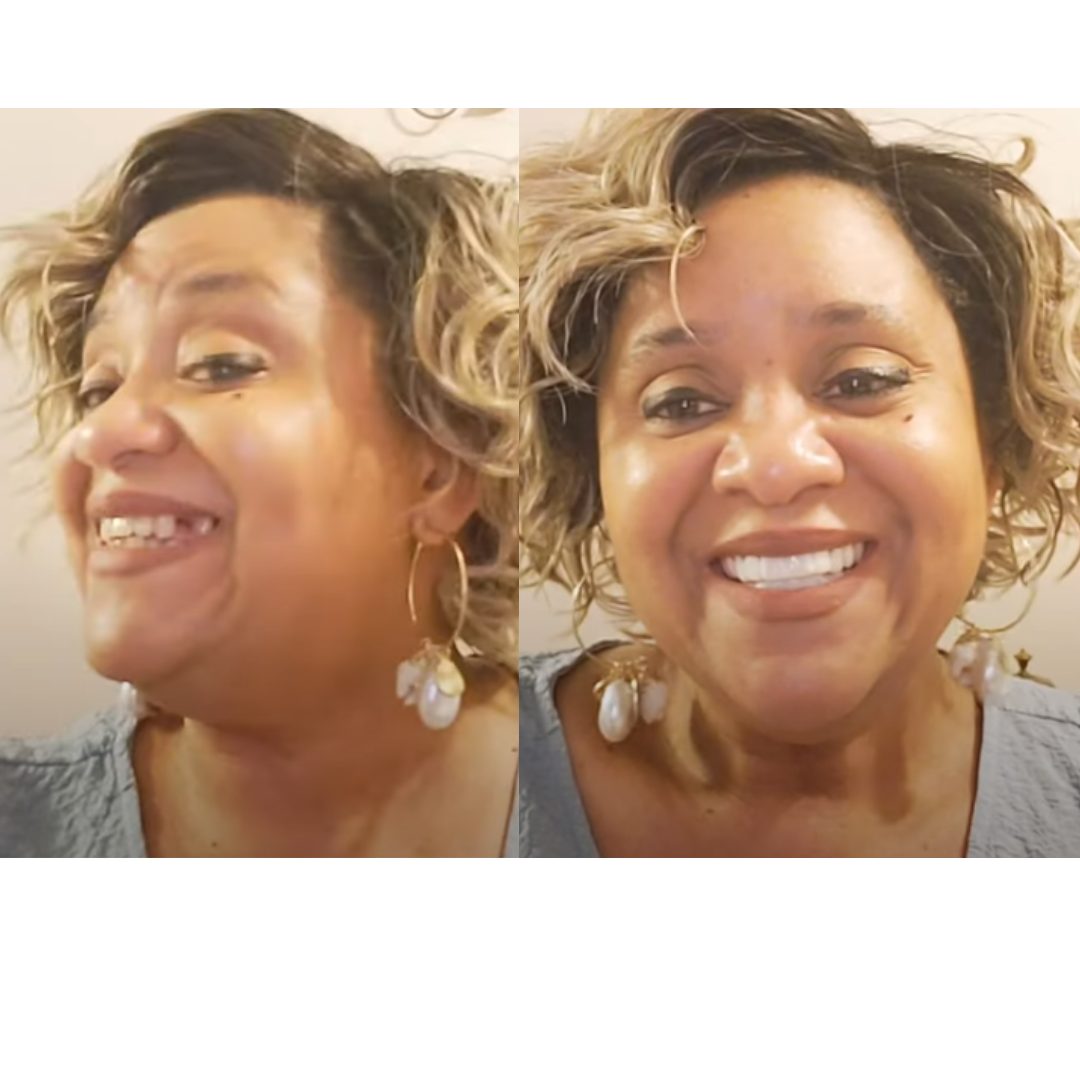 Estoy encantada con mi nueva sonrisa