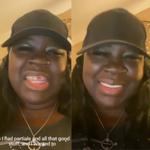 Sí, ¡las chapas Pop On!