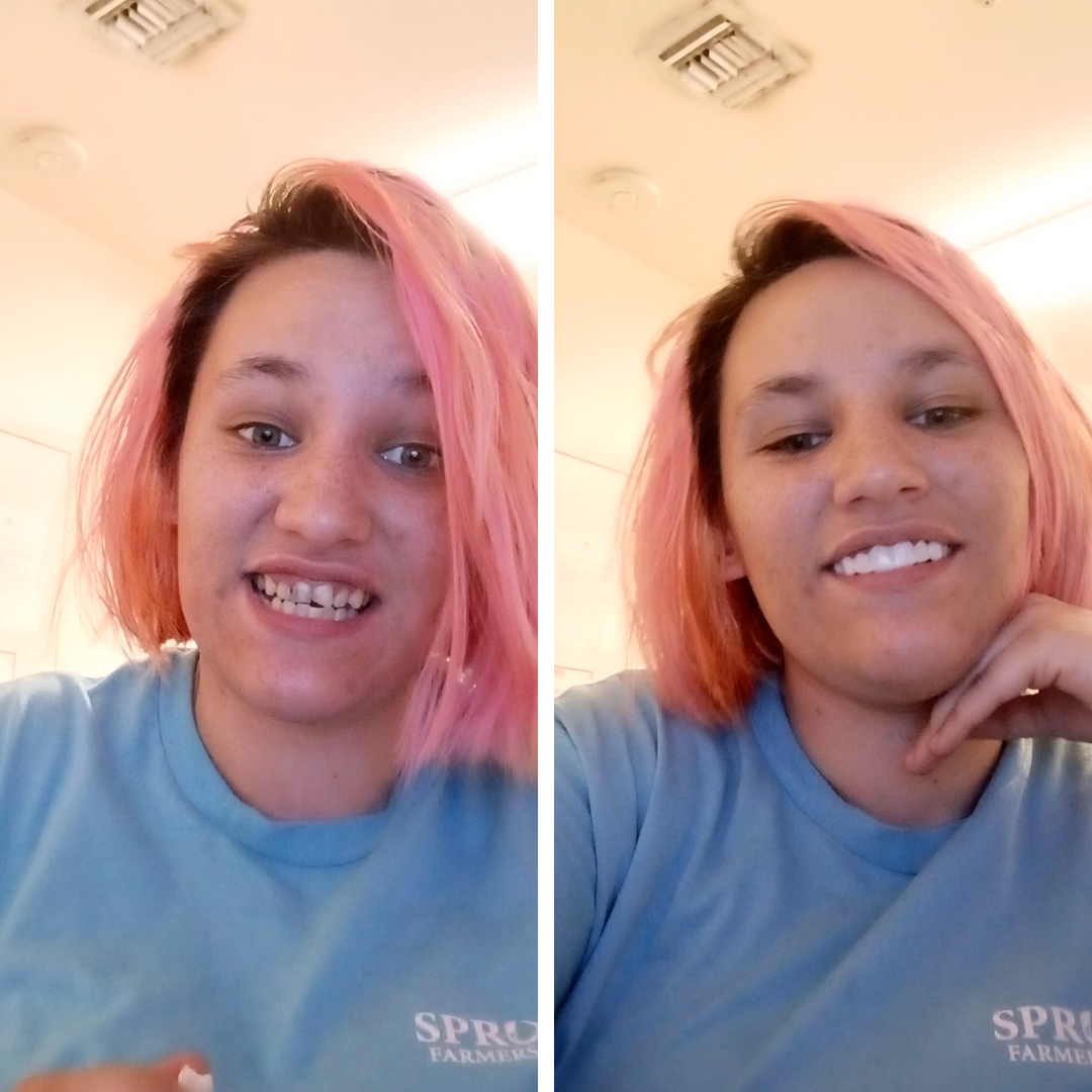 ¡Tachán! ¡Nueva sonrisa!