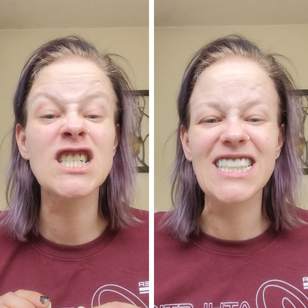 Se ajusta perfectamente y es muy fácil.