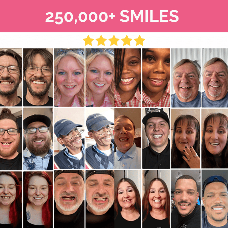 Carillas Pop On con kit de impresión