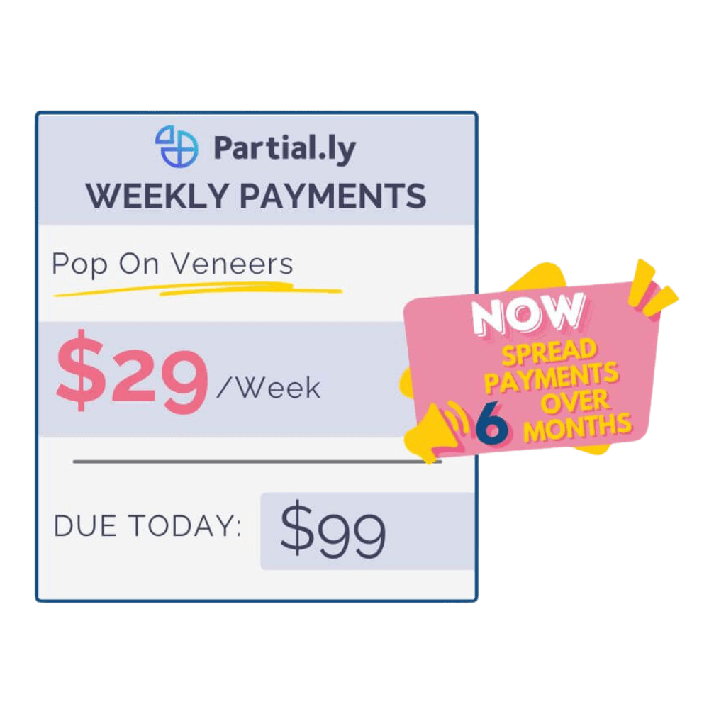 Plan de pago - Carillas Pop On - Con kit de impresión en casa