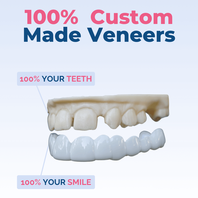 Spare Veneers