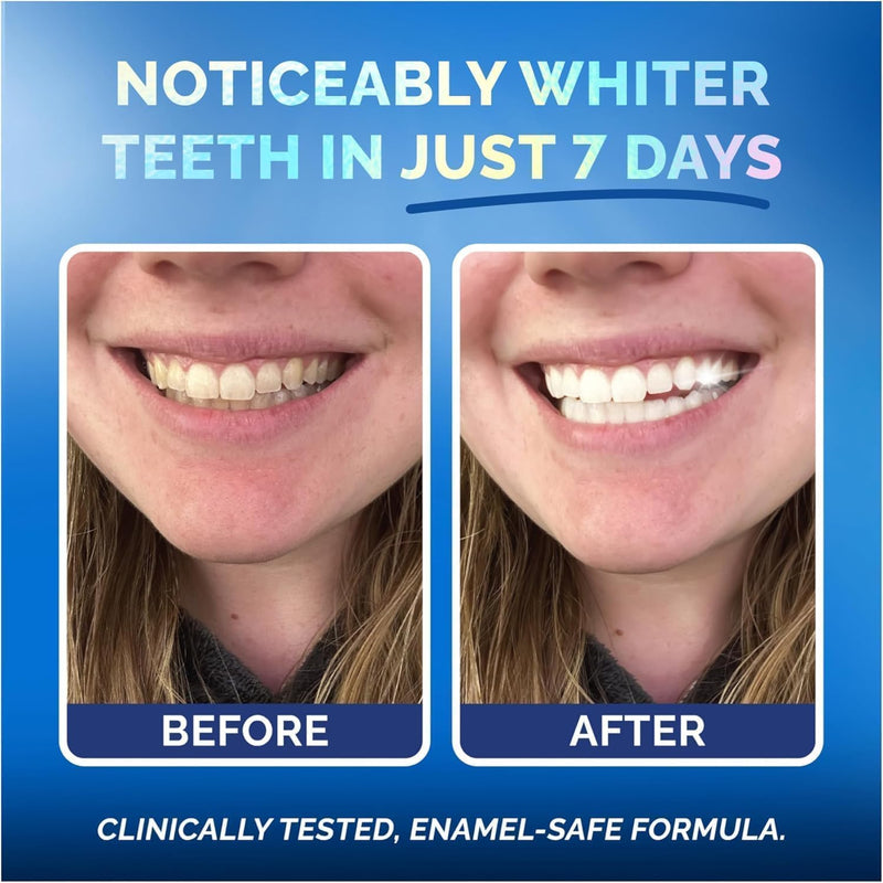 Pop Out Tooth Pop On Teeth Whitening Strips for Sensitive Teeth and Gums – Pop On Veneers