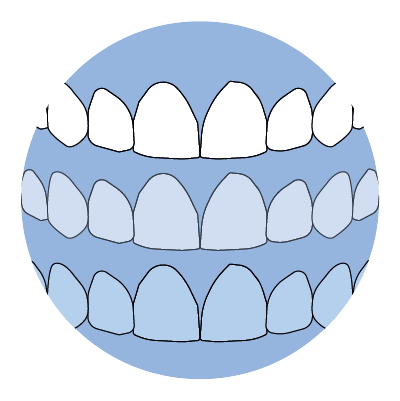 Check out color options for your new smile from Pop On Veneers! Hollywood white, Natural white, Mature Tan