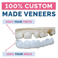 PDP_100__CUSTOM_MADE_VENEERSx500.webp