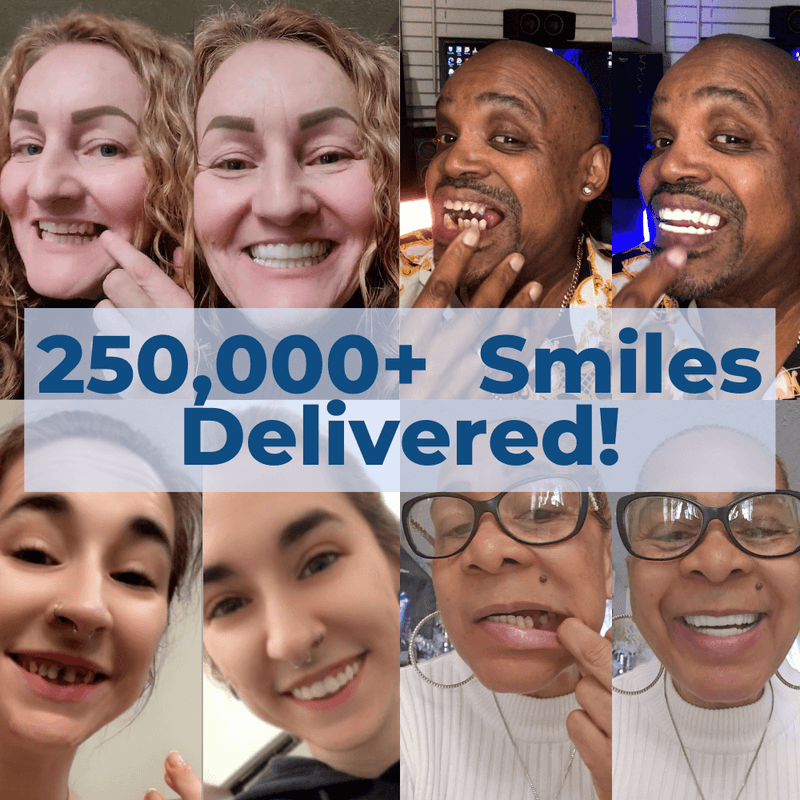 Add Opposite Arch After Veneers Delivered