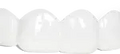 Veneers_Product_Listing_Holldywood_White_2_Transparent.webp