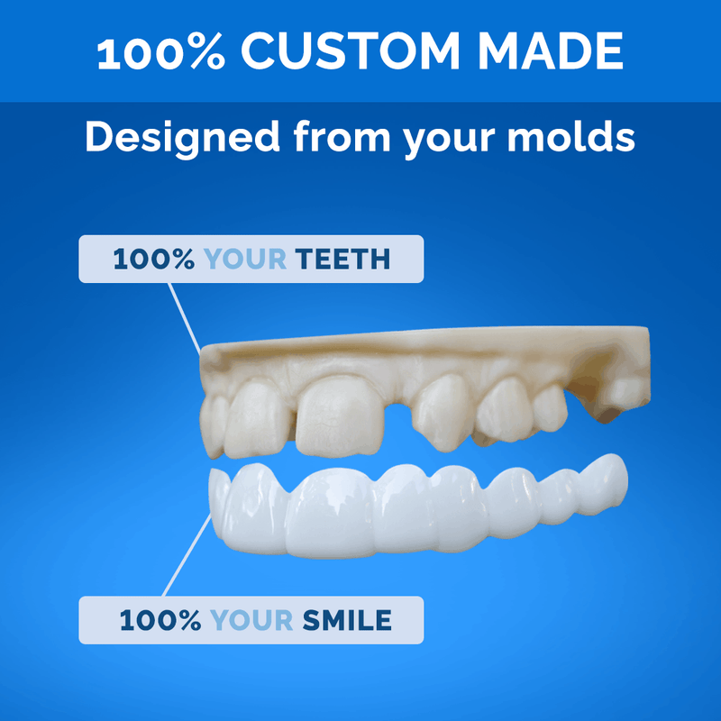 Pop On Veneers with Impression Kit