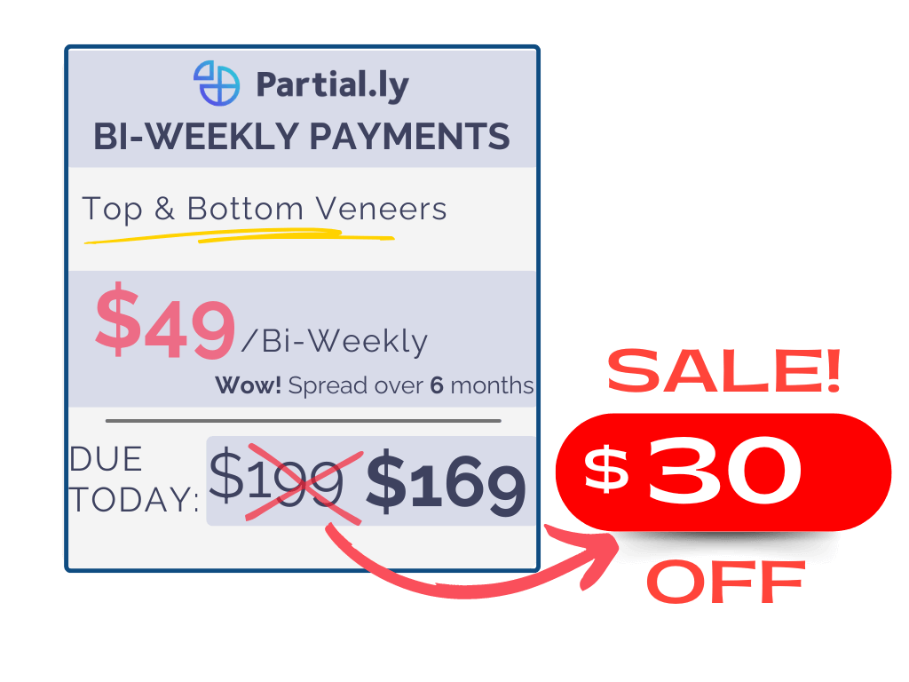 Bi-Weekly Payment Plan - Pop On Veneers - $30 Off