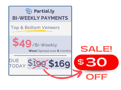 Bi-Weekly Payment Plan - Pop On Veneers - $30 Off