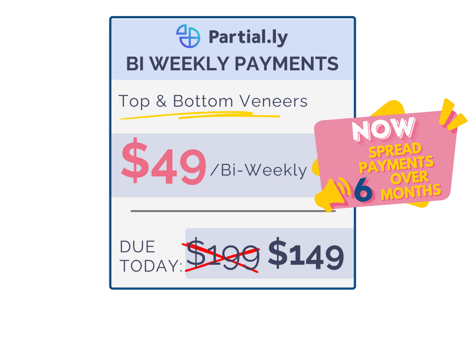 products-pop-on-veneers