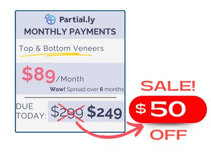 Monthly Payment Plan - Pop On Veneers - $50 Off