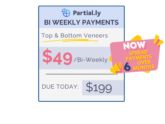 Bi-Weekly Payment Plan - Pop On Veneers